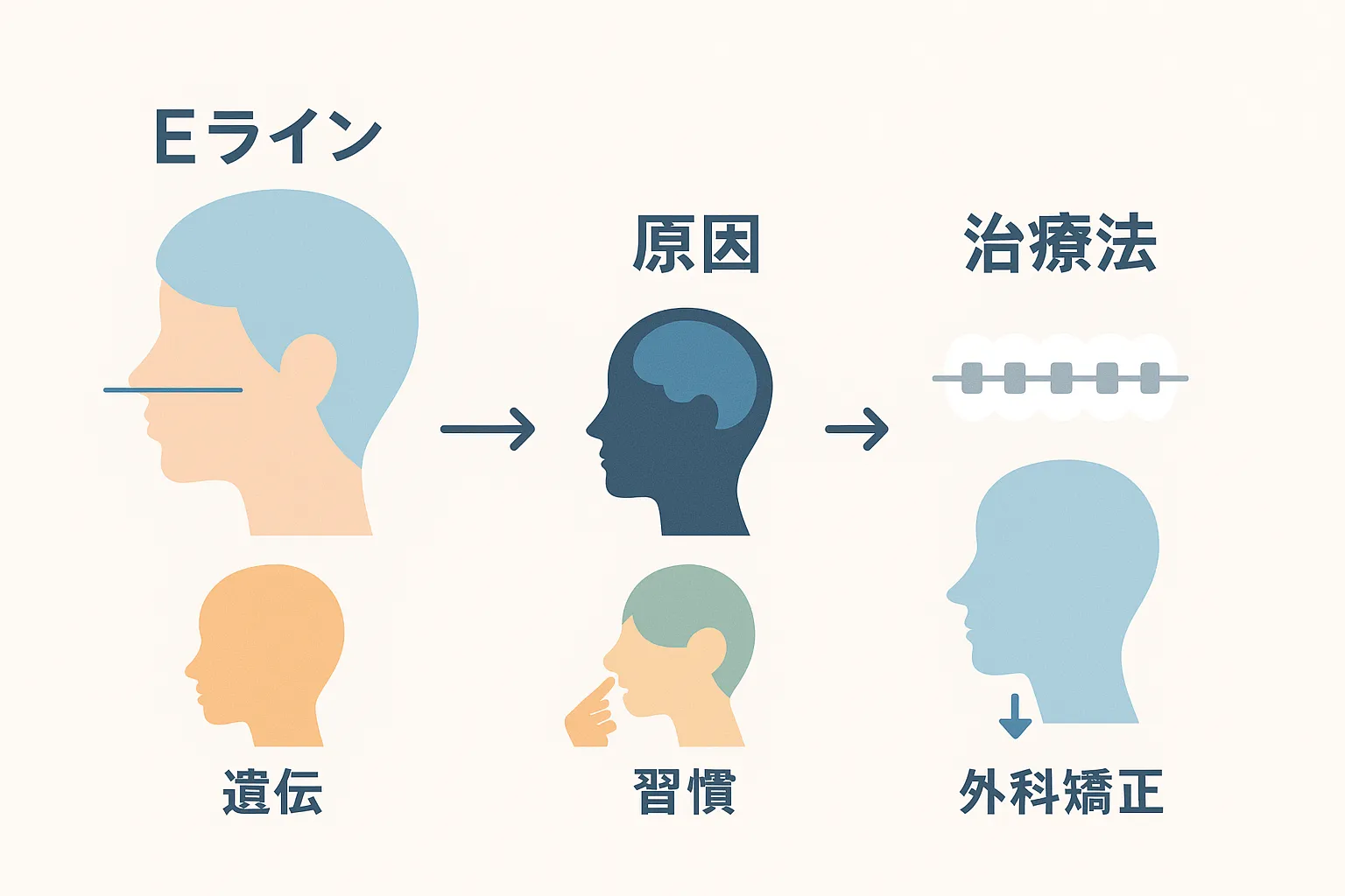 中条あやみみたいな口ゴボの原因と治療法